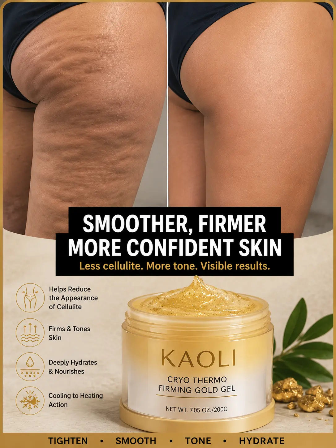 Before and after: the look of cellulite